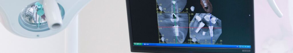 歯科用CTで虫歯は見える？